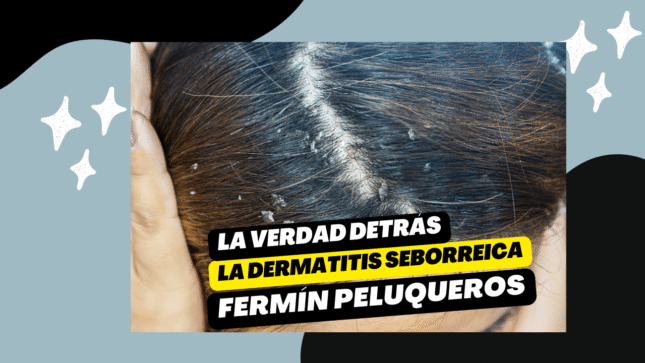 La verdad detrás de la dermatitis seborreica