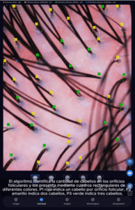 cap6